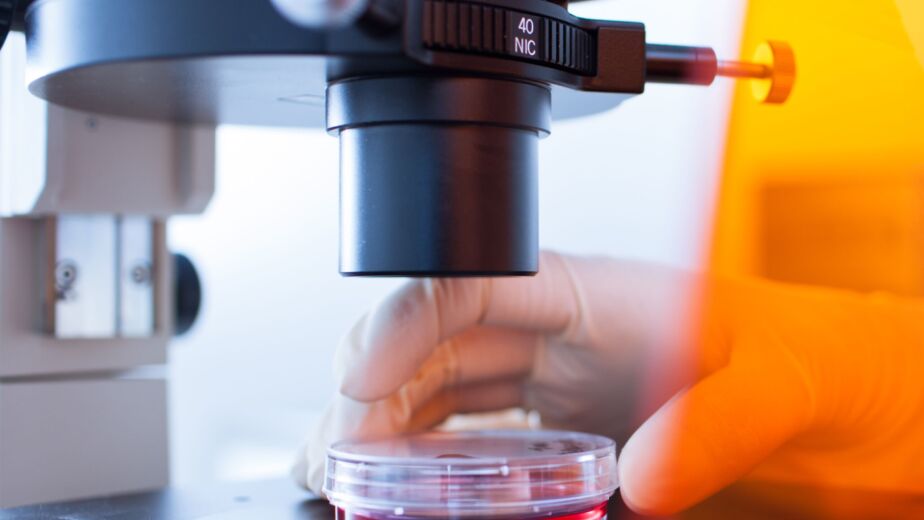 Max a man in his 30s Case Study