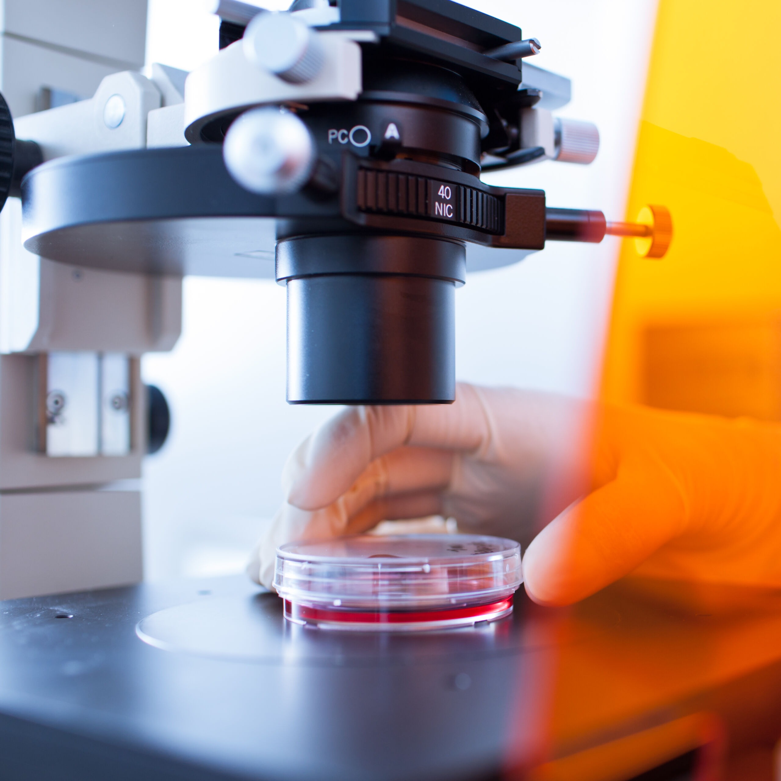 Max a man in his 30s Case Study