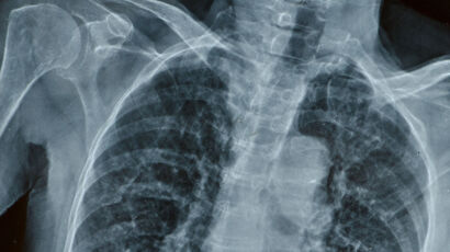 Philippa 58 a man in his 50s